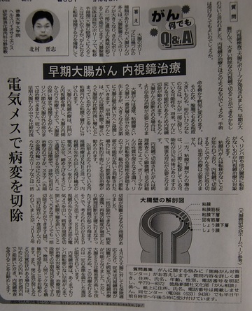 〇徳島新聞に「がん何でもＱ＆Ａ」が掲載されました（平成25年11月18日付け）