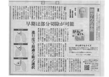 肺がんの手術